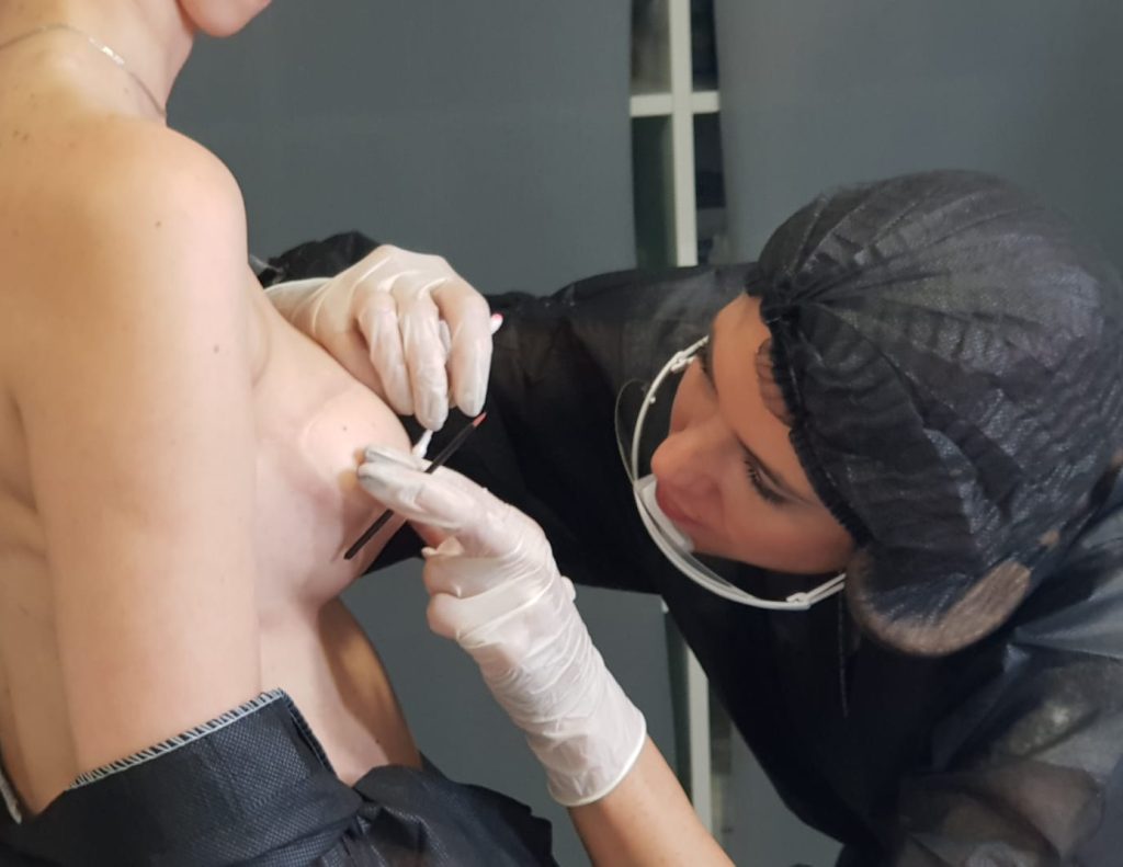 tatuaje reconstructivo 2