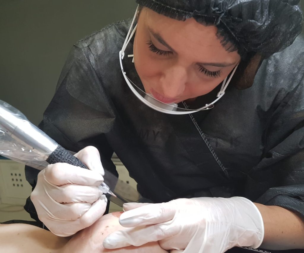 tatuaje recostructivo 2